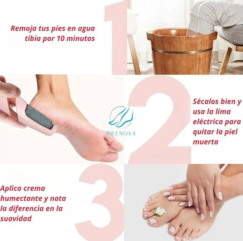Removedor Eléctrico de Callos